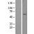 Western Blot: ABCD4 Lysate [NBL1-07181] - Western Blot experiments. 
Left-Control; Right -Over-expression Lysate for ABCD4